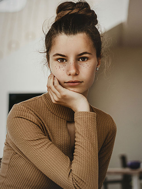treatment_AcneScars