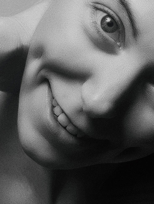 treatment_Dimple